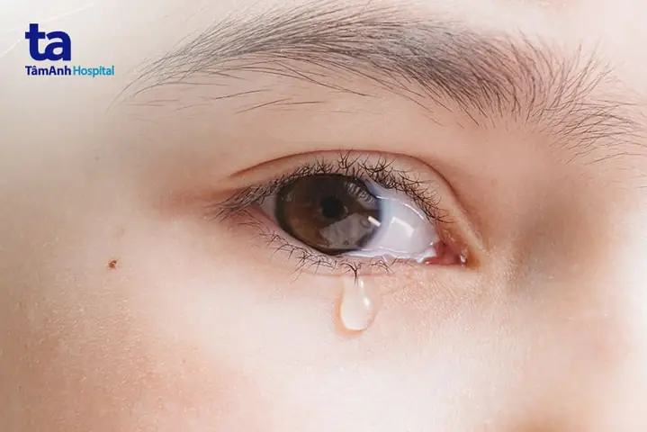 Ấn Vào Mắt Thấy Đau: Nguyên Nhân, Cách Xử Lý Và Khi Nào Cần Đi Khám