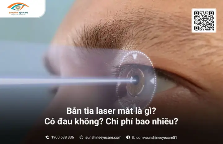Bắn Laser Mắt Là Gì? Tổng Tất Tần Tật Về Phẫu Thuật Khúc Xạ