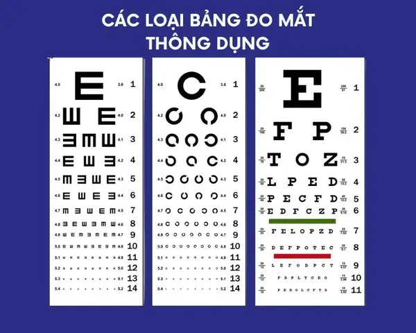 Bảng Đo Mắt Chữ C: Tổng Tất Cả Loại Và Cách Dùng Chuẩn Y Khoa