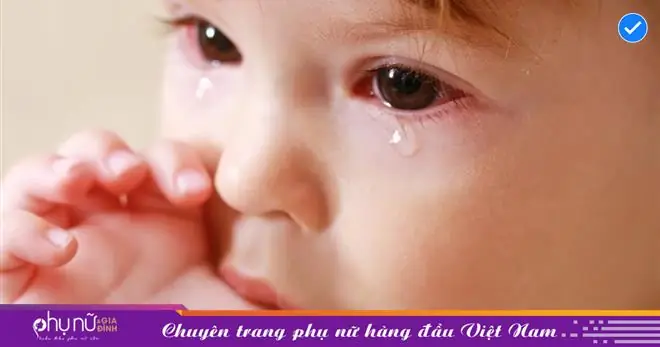 Bé Bị Đau Mắt Nhiều Ghèn: Nguyên Nhân & Cách Xử Lý Tại Nhà