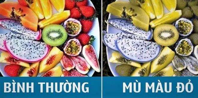 Bệnh Mù Màu Có Chữa Được Không? Tất Tần Tật Thông Tin Cần Biết