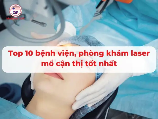 Bệnh Viện Mổ Cận Thị Tốt Nhất: Đánh Giá Chi Tiết 10 Địa Chỉ Uy Tín Tại Việt Nam