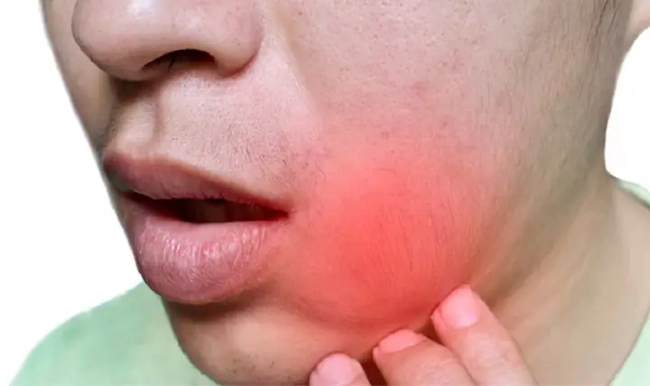 Đau Bên Trong Má Phải: Nguyên Nhân, Triệu Chứng Và Cách Xử Lý