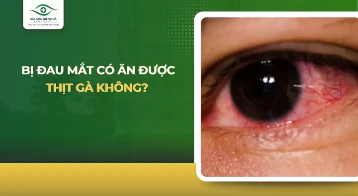Đau Mắt Có Nên Ăn Thịt Gà Không?