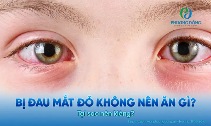 Đau Mắt Đỏ Không Nên Ăn Gì? Danh Sách Thực Phẩm Cần Tránh