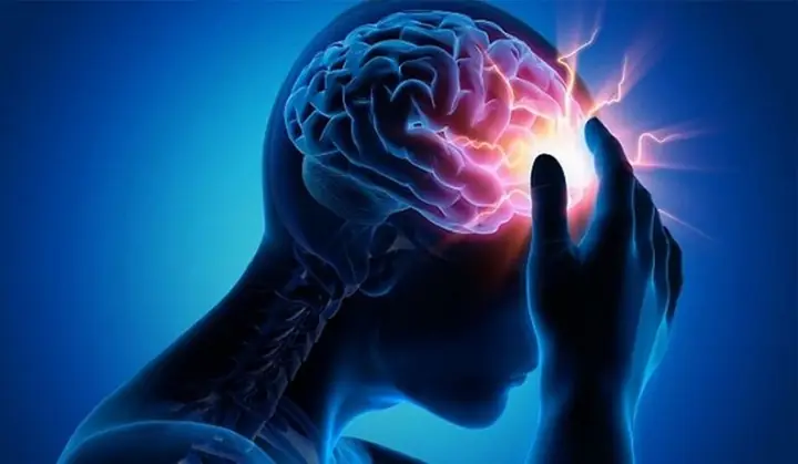 Bị Giật Dây Thần Kinh Trên Đầu: Nguyên Nhân, Triệu Chứng Và Cách Xử Lý