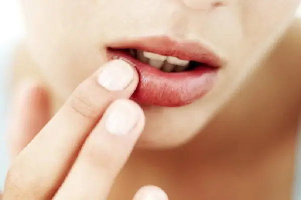 Bị Giật Môi Trên Bên Trái: Nguyên Nhân & Cách Xử Lý Đúng Cách