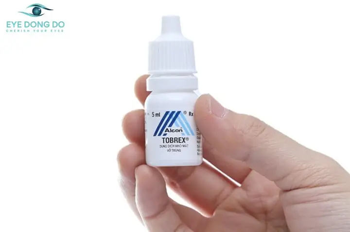 Bị Mộng Mắt Nhỏ Nên Dùng Thuốc Gì? Thông Tin Cần Biết