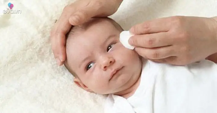 Sưng Mắt Có Ghèn Là Dấu Hiệu Bệnh Gì? Nguyên Nhân & Cách Xử Lý