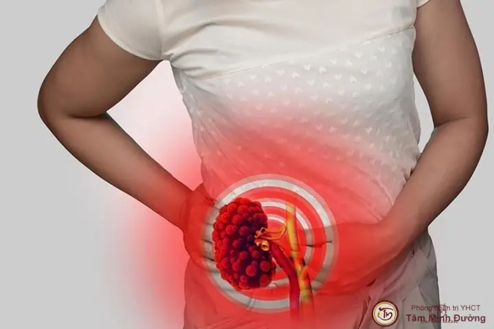 Thận Yếu Ở Nữ Giới: Nhận Biết 15 Dấu Hiệu Sớm Và Cách Phòng Ngừa Hiệu Quả