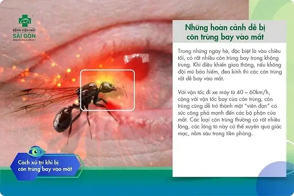 Bồ Hóng Bay Vào Mắt: Nguyên Nhân Và Cách Xử Lý Hiệu Quả