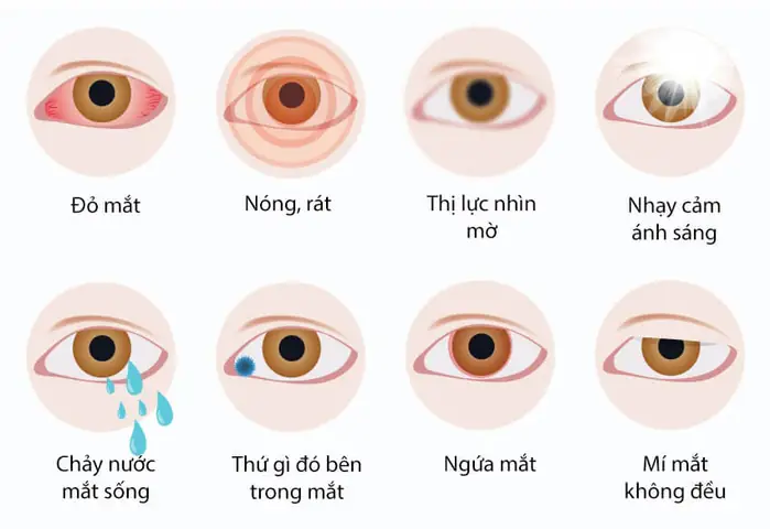 Các Dấu Hiệu Bệnh Về Mắt Bạn Cần Biết Để Phát Hiện Sớm