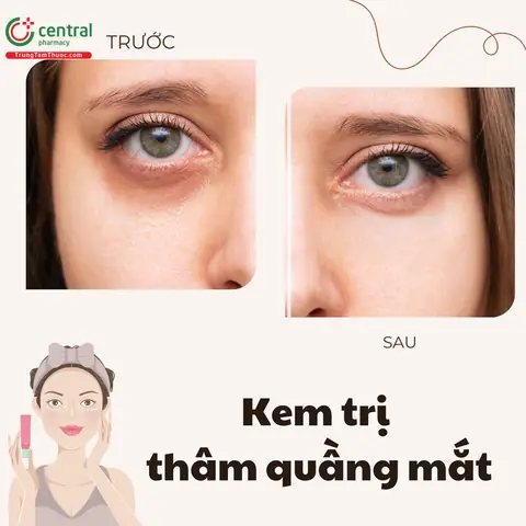 Các Loại Kem Trị Thâm Mắt Hiệu Quả