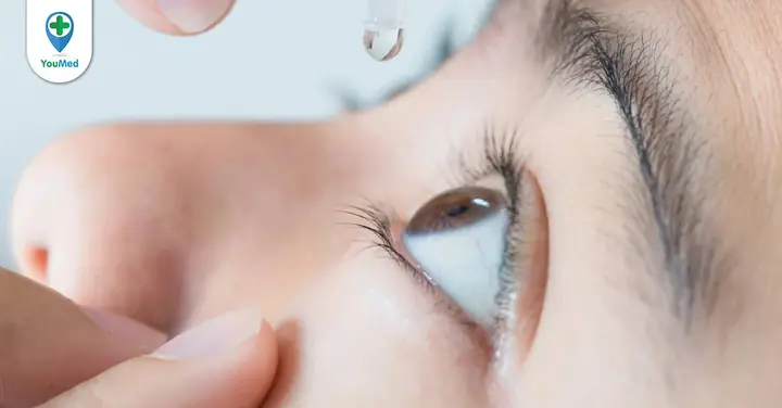 Các Loại Thuốc Nhỏ Mắt Tốt Nhất: Phân Loại Theo Bệnh Lý & Hướng Dẫn Sử Dụng