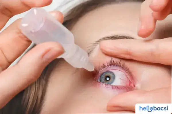 Các Loại Thuốc Nhỏ Mắt Trị Viêm Kết Mạc Cần Biết