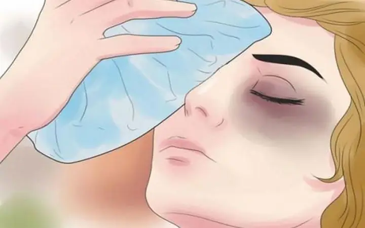 Cách Chữa Đau Mắt Hàn Tại Nhà Hiệu Quả, An Toàn
