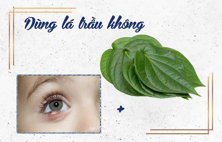 Cách Chữa Lẹo Mắt Bằng Lá Trầu Không