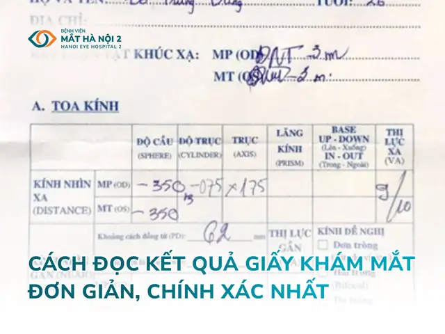 Cách Đọc Giấy Khám Mắt Đơn Giản: Bảng Ký Hiệu & Phiếu Kết Quả Chi Tiết