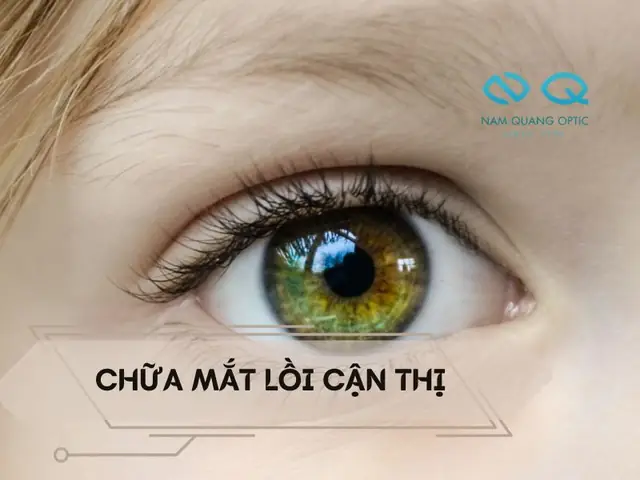 Cách Làm Mắt Đỡ Lồi Đầy Đủ Nhất