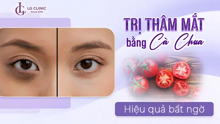 Cách Trị Thâm Mắt Bằng Cà Chua Hiệu Quả Tại Nhà
