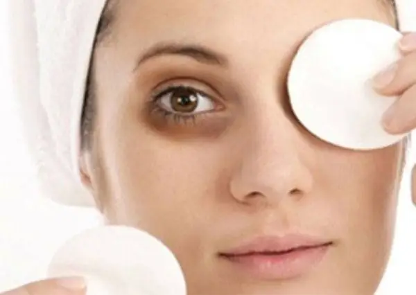 Cách Trị Thâm Mắt Tại Nhà Nhanh Nhất: 6 Phương Pháp Tự Nhiên