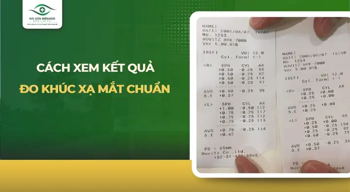 Cách Đọc Kết Quả Đo Khúc Xạ Mắt: Hướng Dẫn Chi Tiết Cho Người Mới