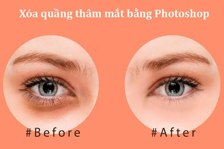 Hướng Dẫn Chi Tiết 2 Cách Xóa Quầng Thâm Mắt Trong Photoshop