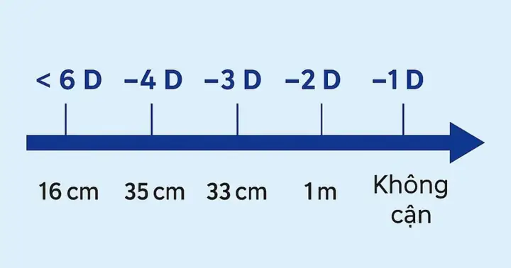 Cận 3 Đi Ốp Là Mấy Độ? Giải Đáp Chi Tiết Về Đơn Vị Đo Cận Thị