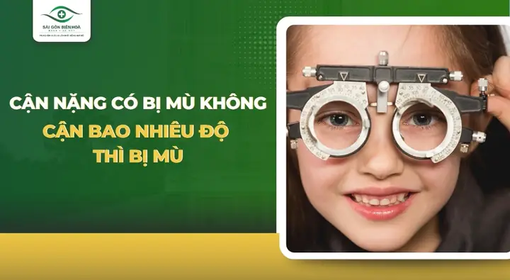 Cận Thị Bao Nhiêu Độ Thì Bị Mù? Phân Tích Toàn Diện Về Nguy Cơ Và Biến Chứng