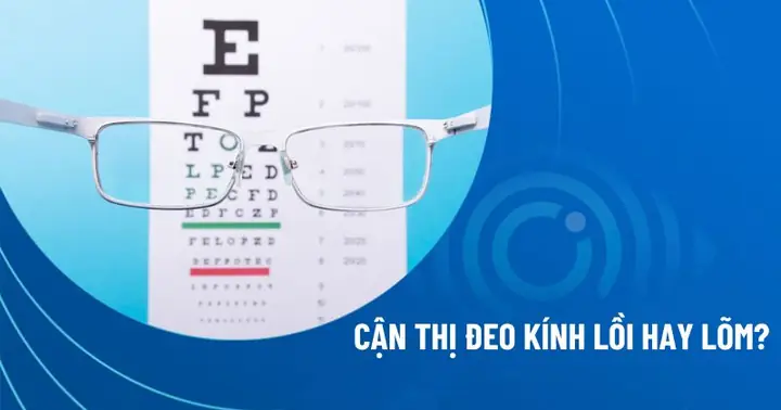 Cận Thị Đeo Kính Lồi Hay Lõm? So Sánh Chi Tiết 2026