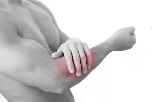 Cánh Tay Bị Sưng Đỏ: Nguyên Nhân Và Cách Xử Lý Hiệu Quả