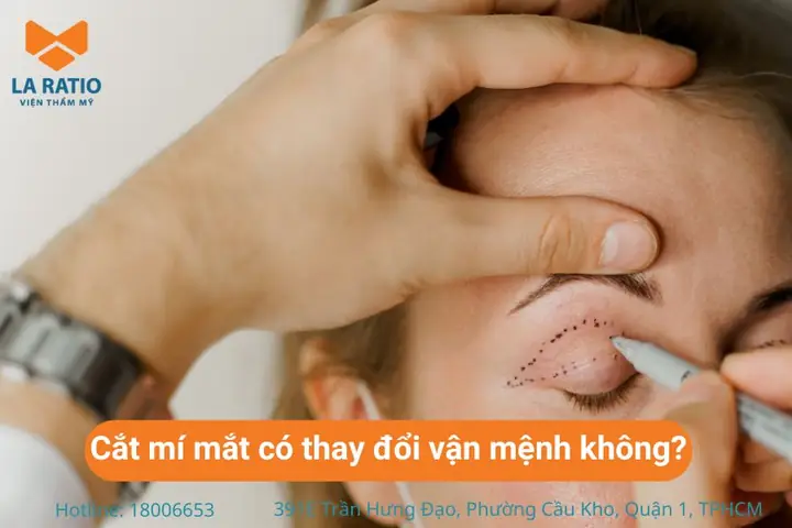 Cắt Mí Mắt Có Phá Tướng Không? Phân Tích Khoa Học Và Phong Thủy