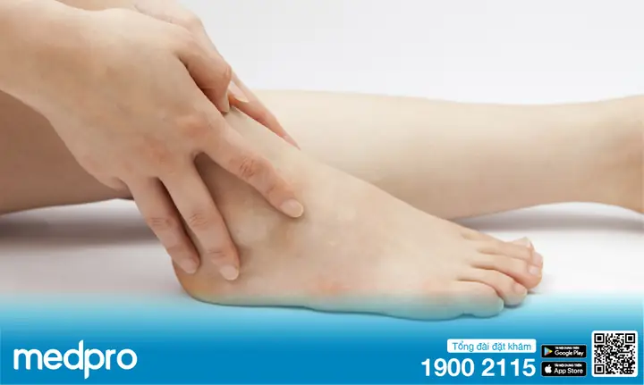Chân Bị Sưng Phù Là Bệnh Gì? Nguyên Nhân & Cách Điều Trị Hiệu Quả Chân Bị Sưng Phù Là Bệnh Gì? Nguyên Nhân & Cách Điều Trị Hiệu Quả