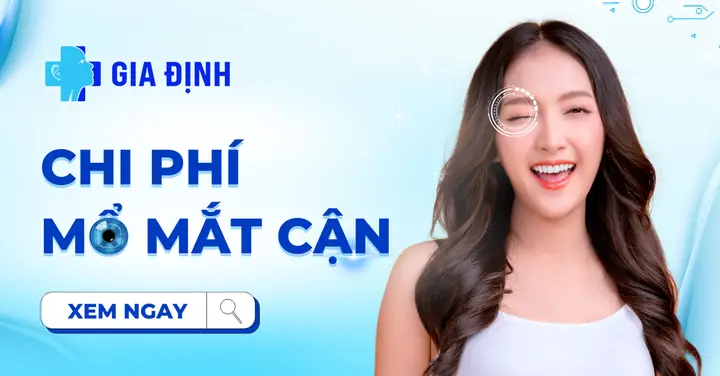 Chi Phí Mổ Mắt Cận 2026: So Sánh Chi Tiết 4 Phương Pháp & Lời Khuyên Chọn Phương Pháp Phù Hợp