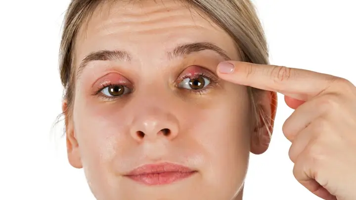 Chữa Lẹo Mắt Bằng Nước Bọt: Phương Pháp Dân Gian Có Thật Sự Hiệu Quả?