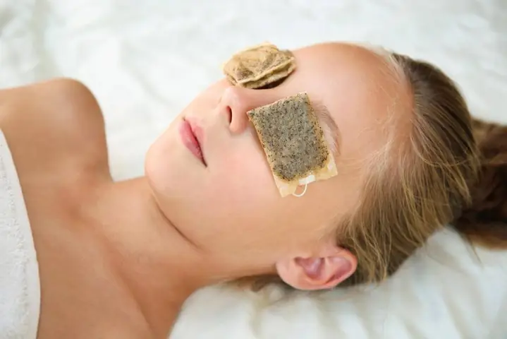 Chữa Lẹo Mắt Dân Gian: 8 Cách Đơn Giản, An Toàn Và Hiệu Quả Tại Nhà