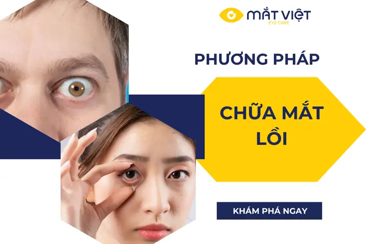 Mắt Lồi Cận Thị: Tìm Hiểu Nguyên Nhân & Các Phương Pháp Điều Trị Hiệu Quả
