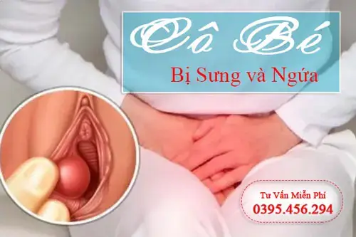 Sưng Và Ngứa Vùng Kín: Nguyên Nhân, Dấu Hiệu Và Cách Xử Lý Hiệu Quả