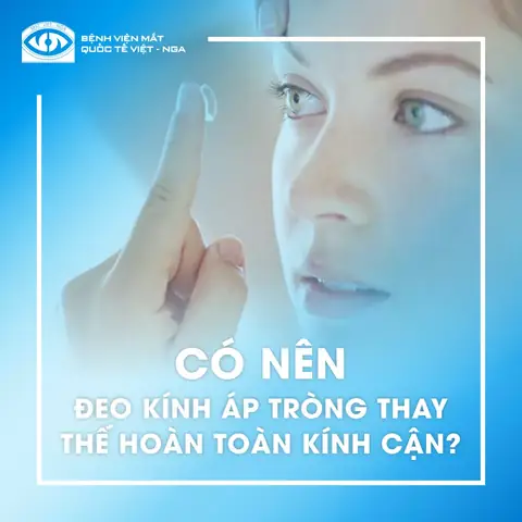 Kính Áp Tròng Thay Kính Cận: Phân Tích Ưu Nhược Điểm Toàn Diện