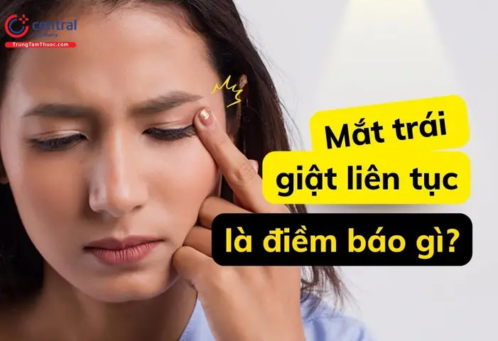 Con Gái Mắt Trái Giật Là Điềm Gì? Phân Tích Từ Y Học Đến Văn Hóa