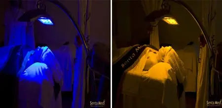 Cách Xử Lý Da Dị Ứng Ngứa Hiệu Quả Và An Toàn