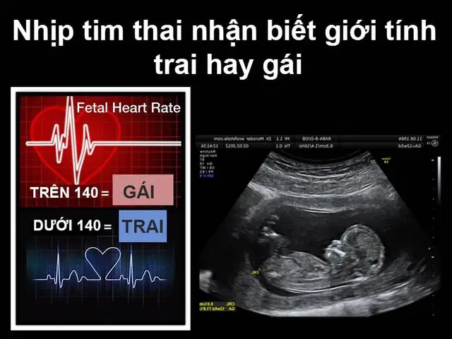 Dấu Hiệu Bầu Trai Hay Gái: Cách Nhận Biết Giới Tính Thai Nhi Khoa Học