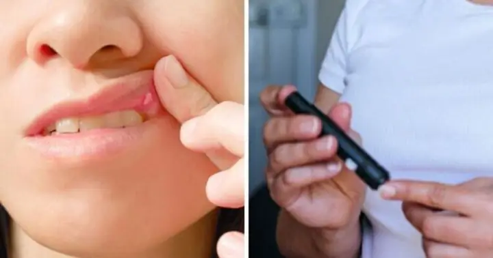 Dấu Hiệu Bệnh Tiểu Đường Ở Nữ: Cảnh Báo Sớm Không Thể Bỏ Quên