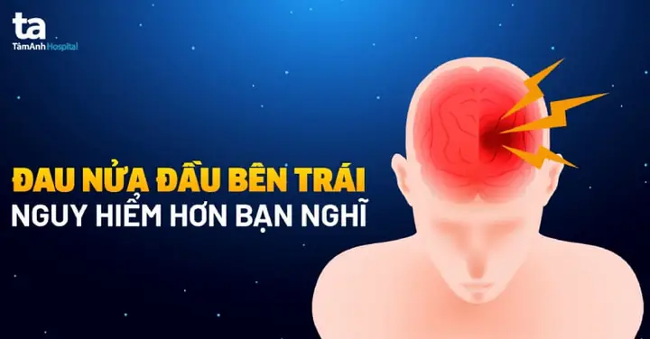 Đau Nhức Nửa Đầu Bên Trái: Nguyên Nhân, Các Dạng Triệu Chứng Và Cách Xử Lý Khi Cần Thiết