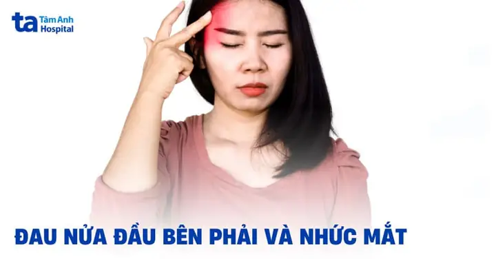 Đau Nửa Đầu Bên Phải Và Nhức Mắt: Nguyên Nhân Và Cách Xử Lý Hiệu Quả