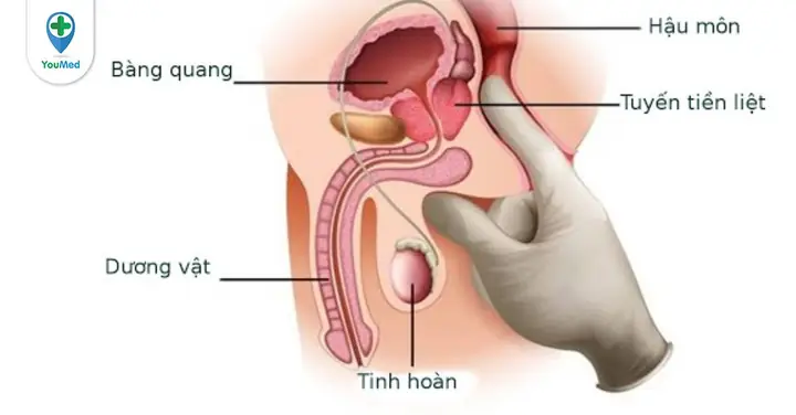 Điểm G Nam Giới Là Gì? Vị Trí, Cách Kích Thích & Lưu Ý Quan Trọng