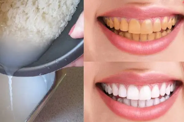 Dùng Nước Vo Gạo Đánh Răng Có Tốt Không? Hướng Dẫn Chi Tiết