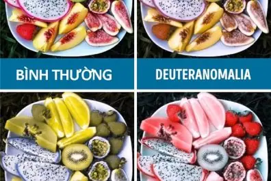 Góc Nhìn Của Người Mù Màu: Khám Phá Thế Giới Màu Sắc Không Đầy Đủ