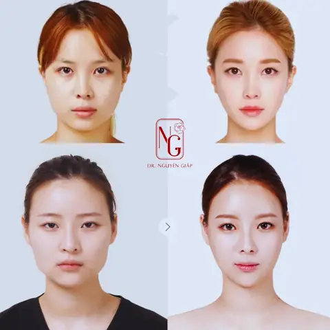 Gương Mặt Hình Trái Tim Là Gì? Đặc Điểm Và Ý Nghĩa