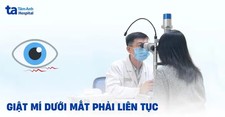 Hiện Tượng Giật Mí Mắt Dưới Bên Phải